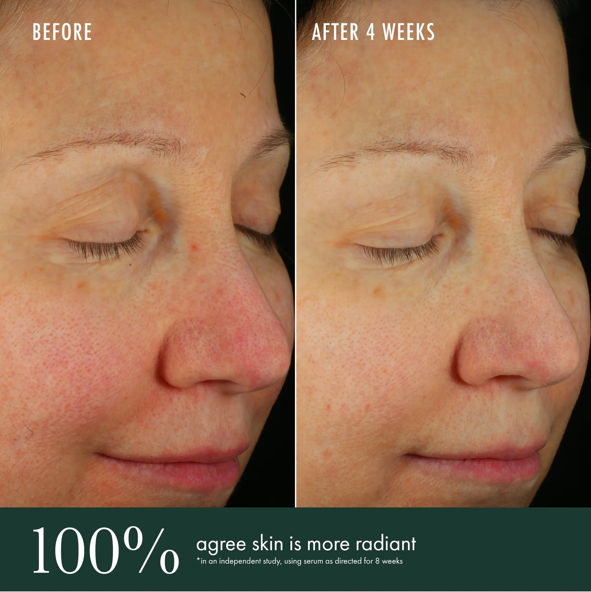 Brightening Serum / Vitamin C   Niacinamide   Bio-Renewal Peptide