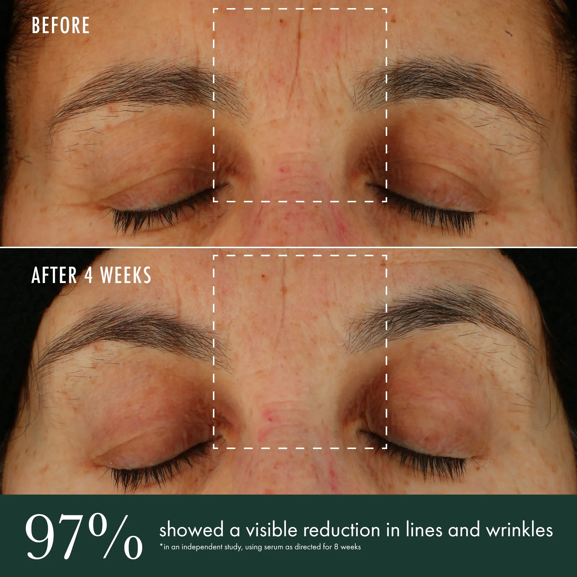 Brightening Serum / Vitamin C   Niacinamide   Bio-Renewal Peptide