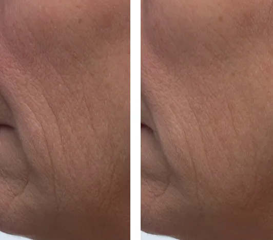 Dr. Denese Triple Strength Peptide Super Drops