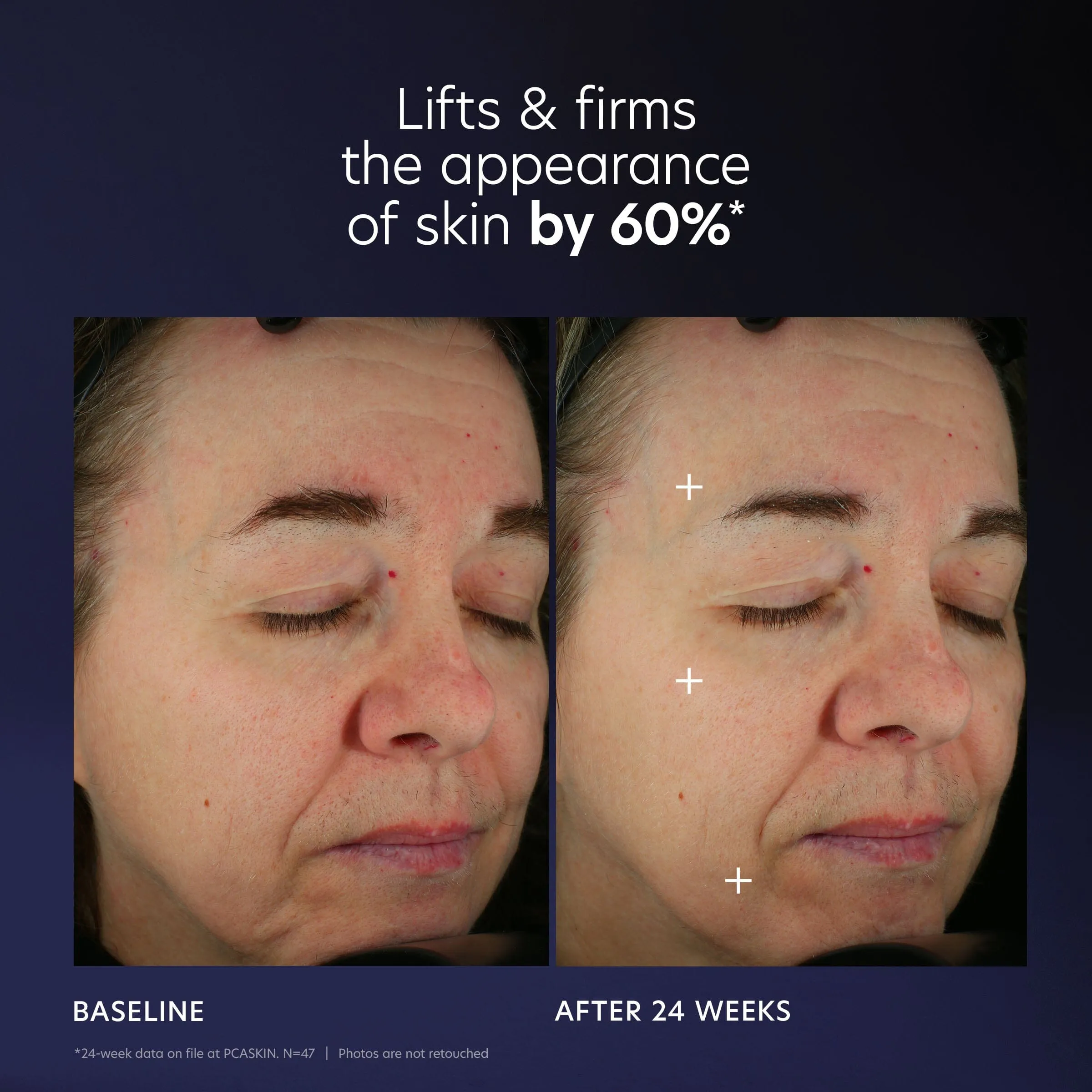 PCA Skin Pro-Max Age Renewal Advanced Anti-aging Serum