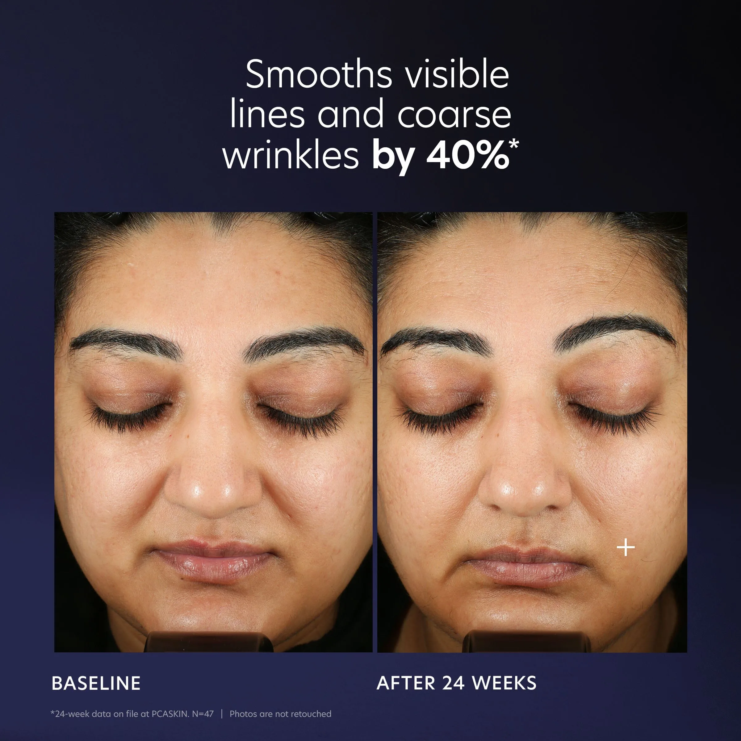 PCA Skin Pro-Max Age Renewal Advanced Anti-aging Serum