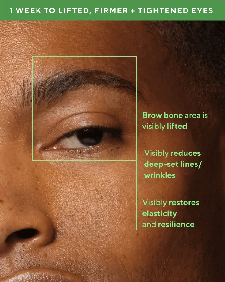 Retinal ReSculpt Eye Lift Treatment